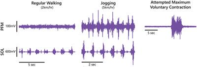 Characterizing Pelvic Floor Muscle Activity During Walking and Jogging in Continent Adults: A Cross-Sectional Study